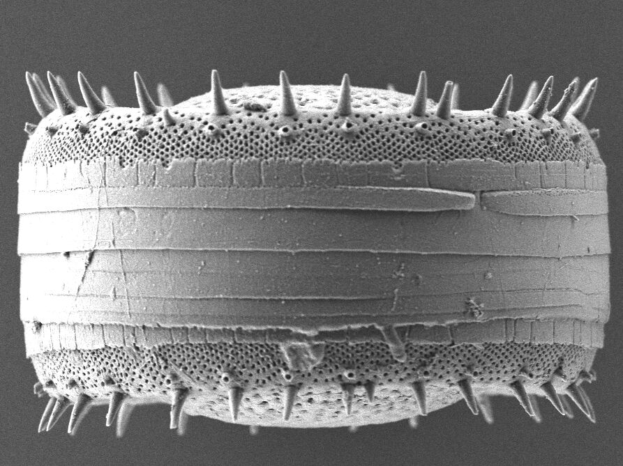 Stephanodiscus neoastraea, Stephanodiscaceae, Kieselalge - REM-Aufnahme-